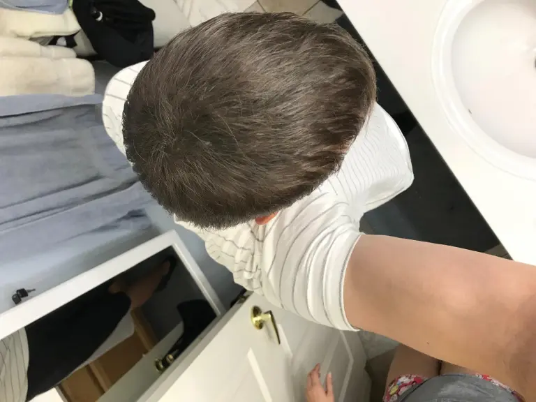 After Bald Hair Kit